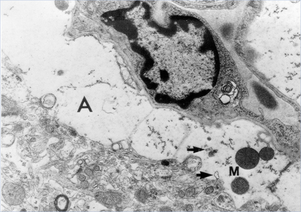 1680_Neuropathological_changes_1