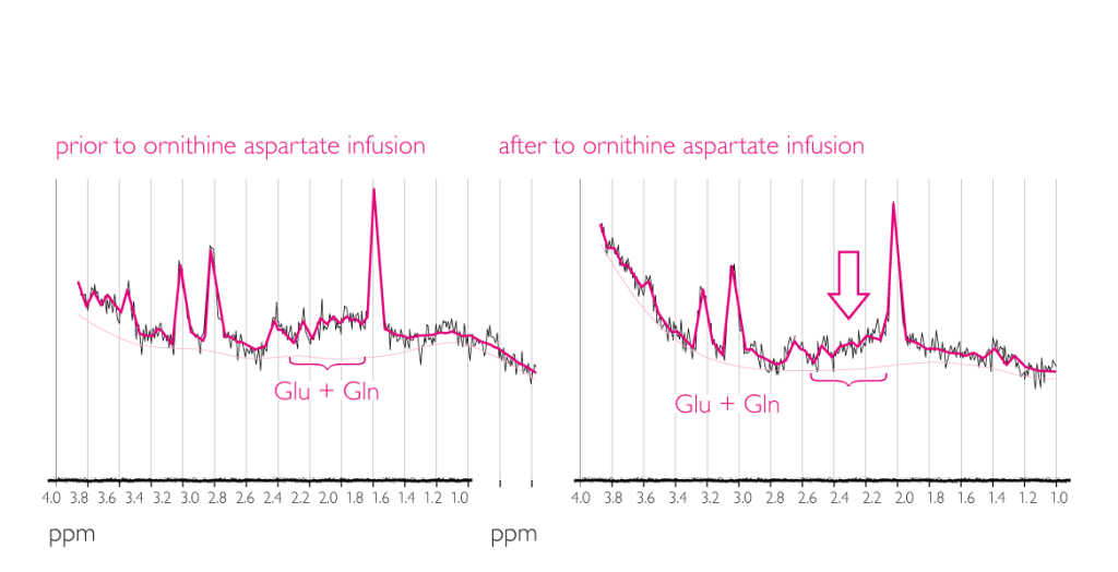 1930_Effect_of_LOLA_on_brain_zoom